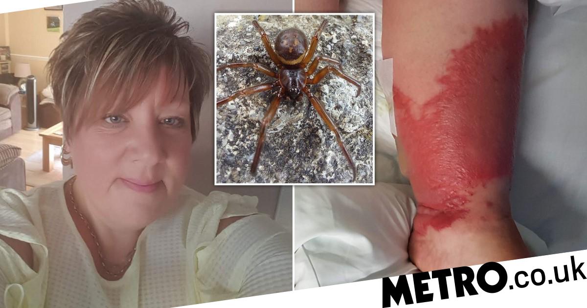 Mum's life 'hung in the balance' after spider bite at garden centre