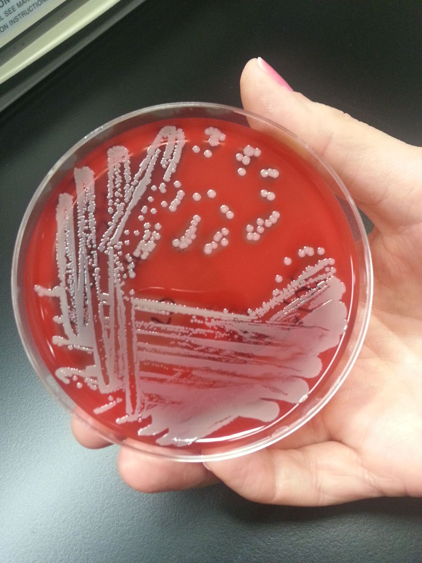 Warning: Staph Bacteria Could Be Affecting Your Milady Now - 9naafwn