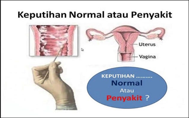 Keputihan Bening Disertai Nyeri Perut | by obat keputihan alami | Medium