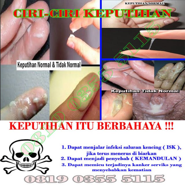 Namun, saat ada rangsangan seksual, produksi lendir keputihan dapat bertambah . Cara Menghilangkan Keputihan Saat Berhubungan Intim Content