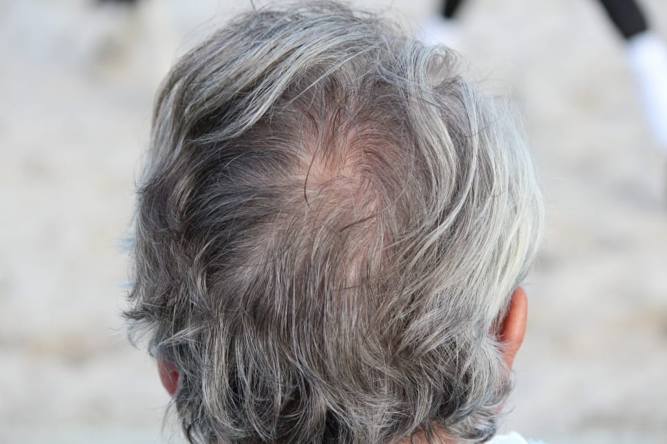 And it's not just because they are black. Can White Hair Turn Black Again 7 Natural Home Remedies For White Hair By Compare Up Medium