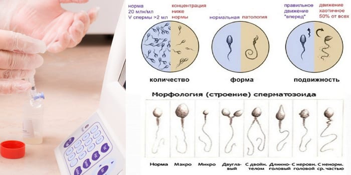 Что делать перед сдачей спермограммы. Как подготовиться к сдаче спермограммы: сколько дней воздержания необходимо? Особенности проведения исследования