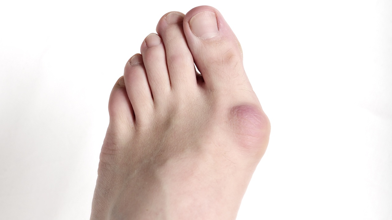 How to use foot in a sentence. Foot Pain And Problems Johns Hopkins Medicine
