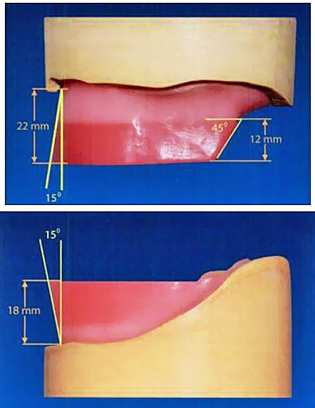 Ideal Requirements Of Denture Base Materials  : Final Report Of The Workshop On Clinical Requirements Of Ideal Denture Base Material 1.