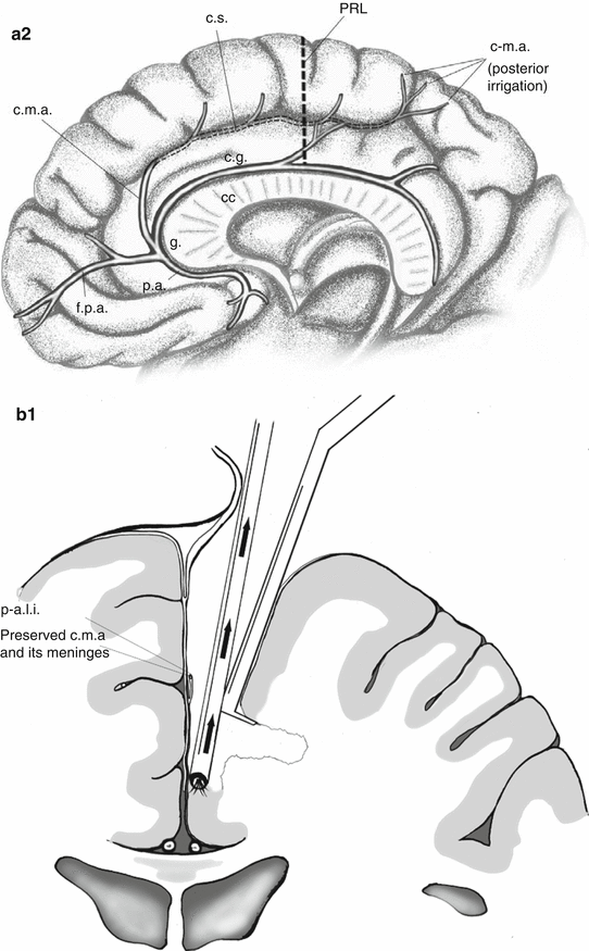 Frontal Lobe Surgery | Neupsy Key