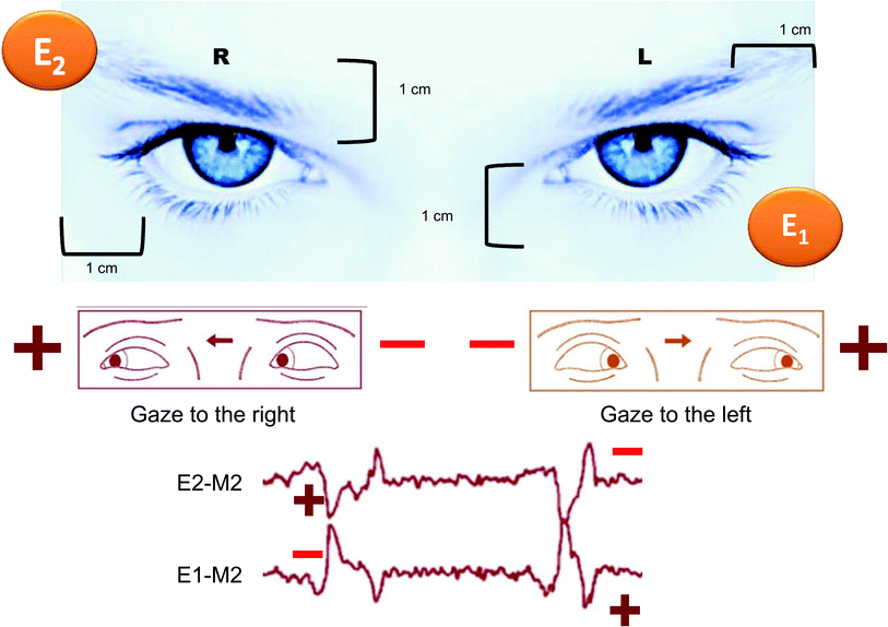 Scoring of Normal Sleep and Arousals Neupsy Key