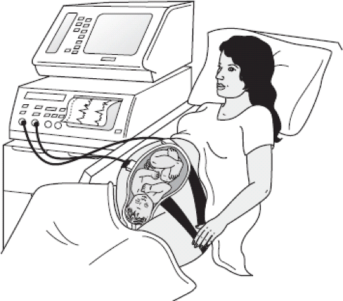 Intrapartum Electronic Fetal Monitoring Nurse Key