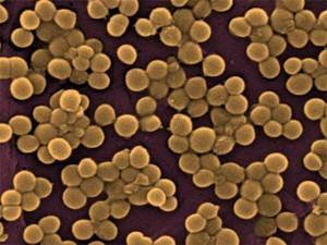 How can it benefit you? Genus Staphylococcus - Nursing Crib