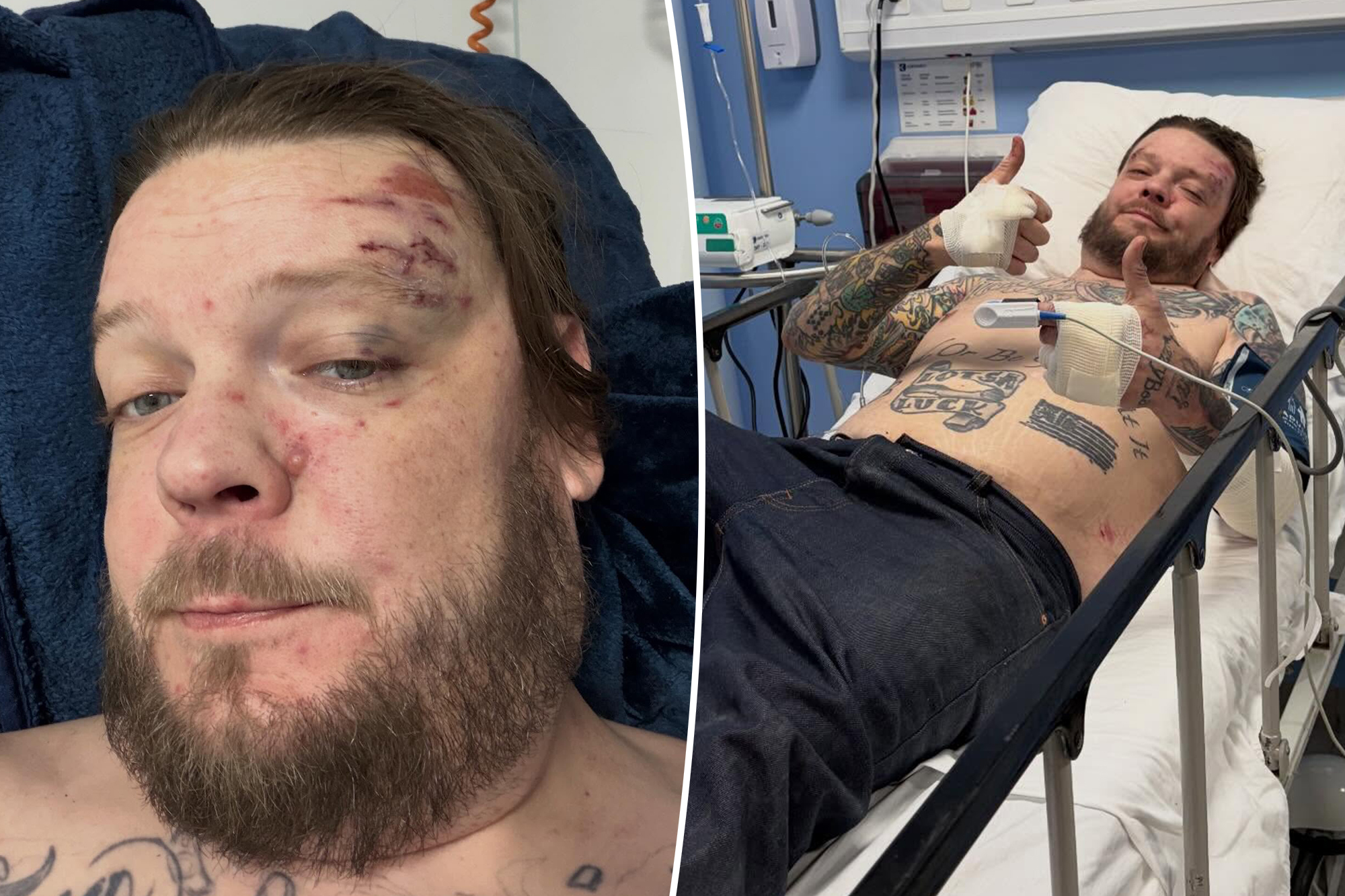 Corey Harrison of ‘Pawn Stars’ breaks 11 ribs in scary motorcycle crash