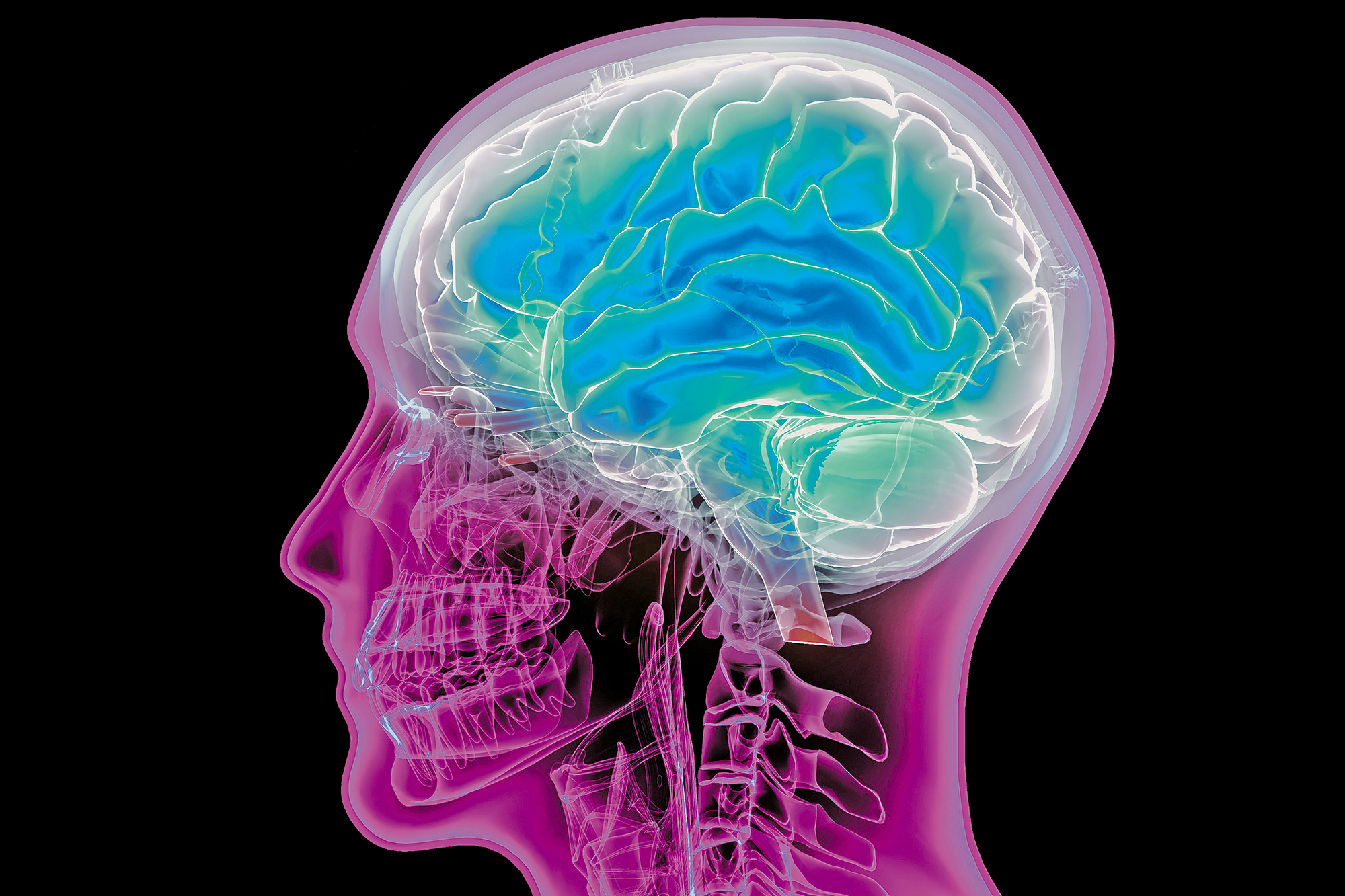 The placebo effect has an evil twin — and it can be deadly