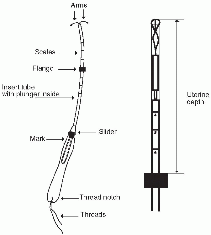 Intrauterine Contraception | Obgyn Key