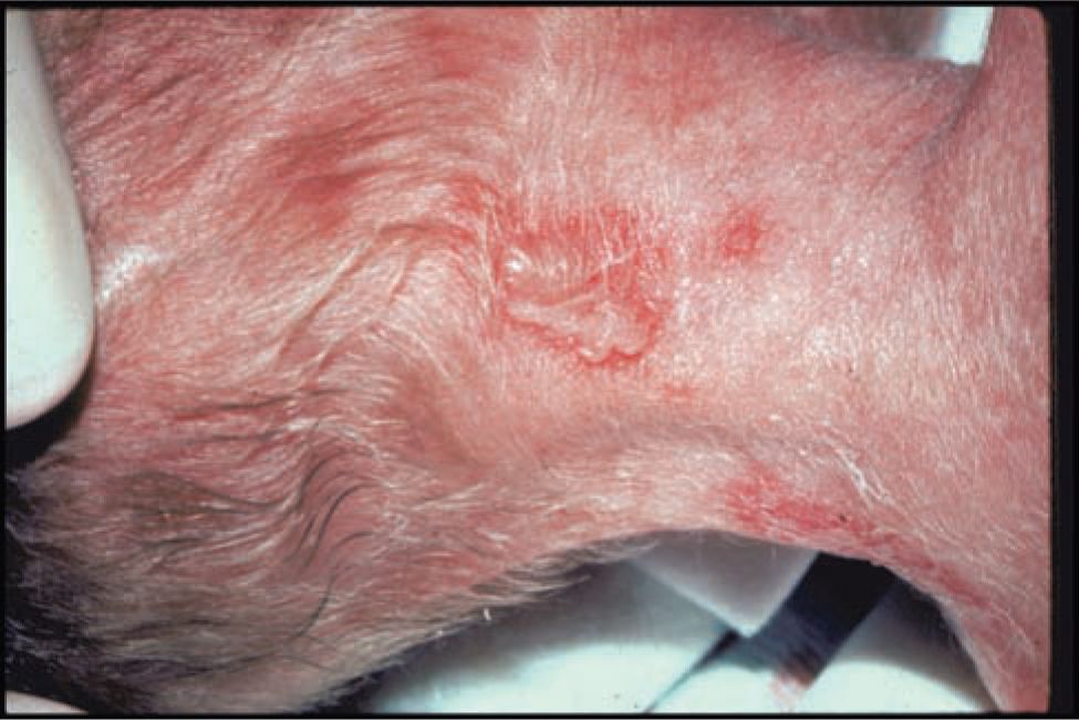 Learn about different types of lesions. Herpes Simplex Virus Obgyn Key