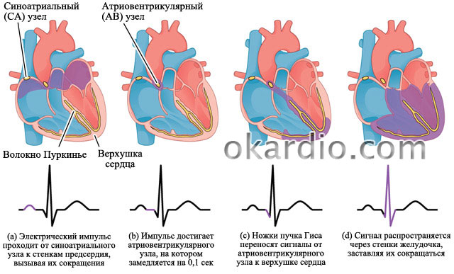 Фібриляція передсердь клініка діагностика лікування.  Класифікація фібриляції передсердь та форми миготливої ​​арит