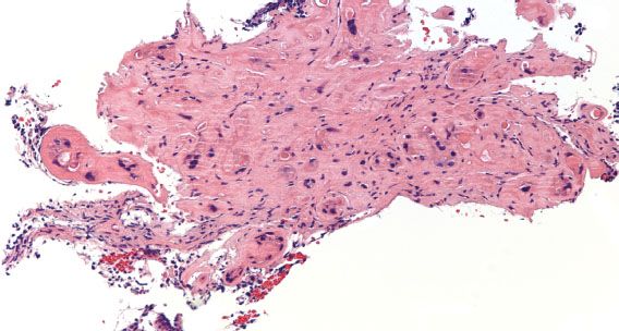 Pathology | Oncohema Key