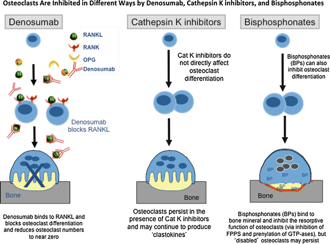 Antiresorptives | Oncohema Key ssl diagram 