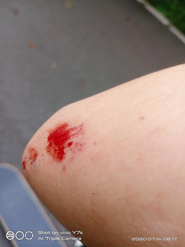 新手一個人練滑板不會摔死嗎？