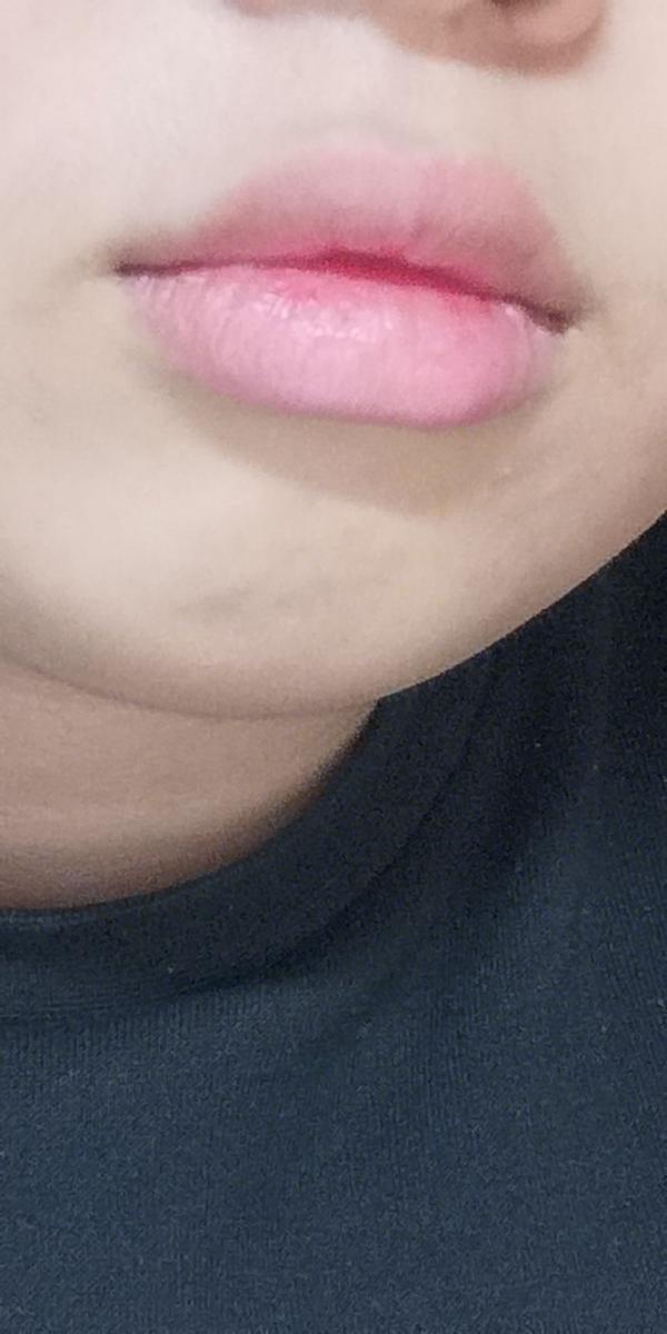 嘴唇厚而且唇形不好看怎麼辦?