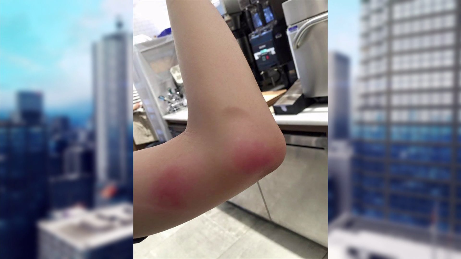 Read 245 tips and reviews from 99 visitors about movies, good for dates and comfortable seats. Apparent Bed Bugs Hit Popular Times Square Movie Theater For A Second Time Pix11