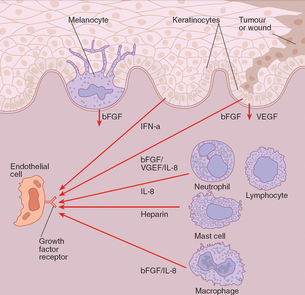 Angiogenesis for the Clinician | Plastic Surgery Key