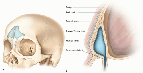Kenali Penyakit Sinusitis Menurut Gejala Hingga Pengobatannya