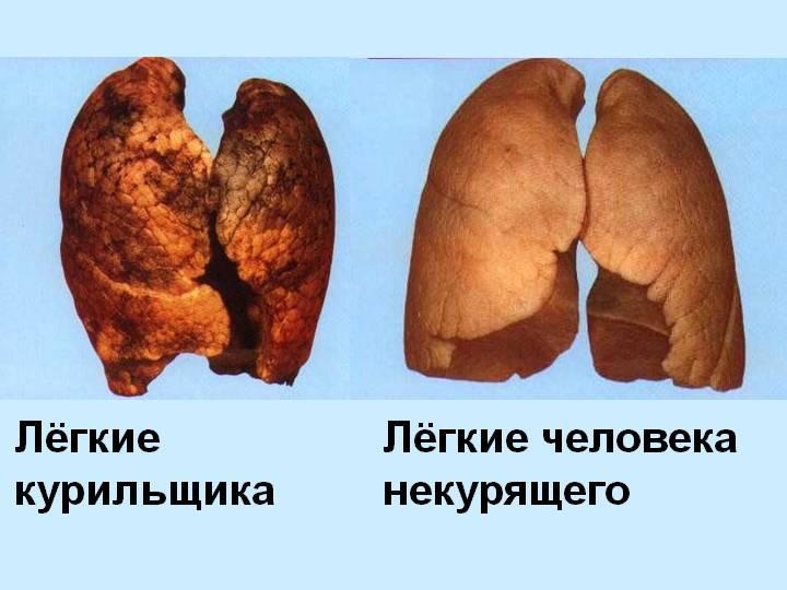 Сутки без сигарет что происходит. Что происходит с организмом, когда мы бросаем курить? Признаки синдрома отмены