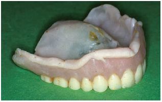 Temporary Denture Base Materials  - Start Studying Denture Base Materials.