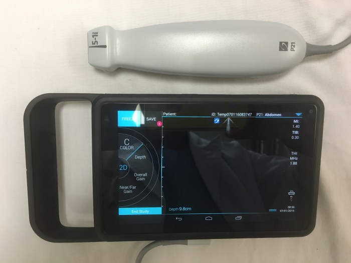 Iviz 手持式超音波全台初體驗 Pocus Academy