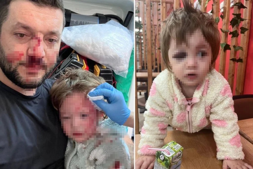Yalova’da dehşet: Baba ve 14 aylık bebeğe saldırı