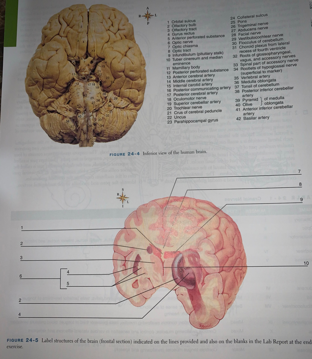 Heart Diagram Frontal Section Labeled Case Study Heart Chief