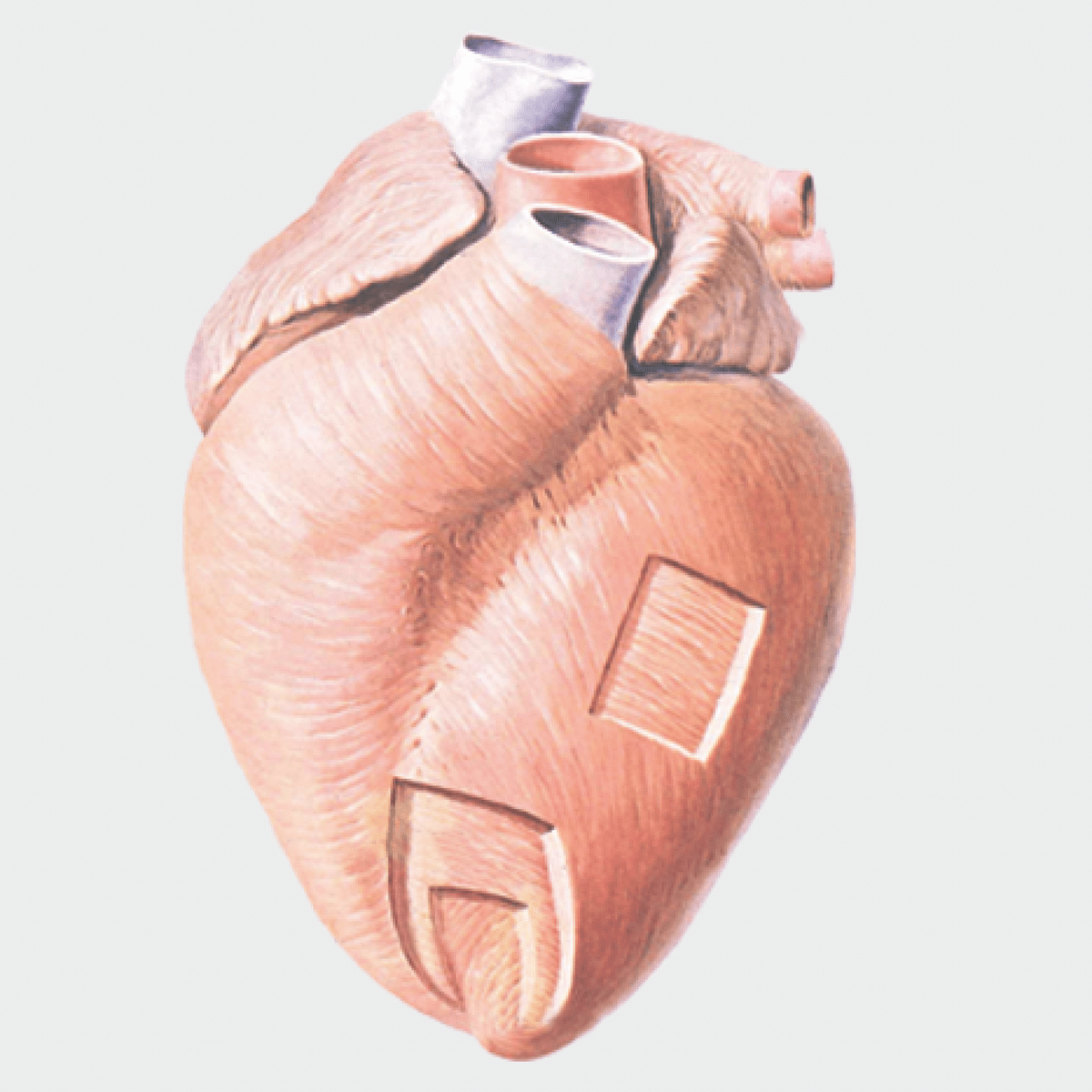 The myocardium is functionally the main constituent of the heart and the thickest layer of all three heart layers. P3106 Cardiac Muscle Layers Prosections