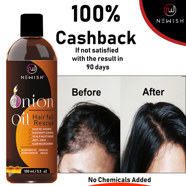 How To Prevent Hair Fall For Male Quora At What Age Do Most Men With Male Pattern Baldness Start Balding Quora Swiss Chard Is A Leafy Green Veggie With Colorful