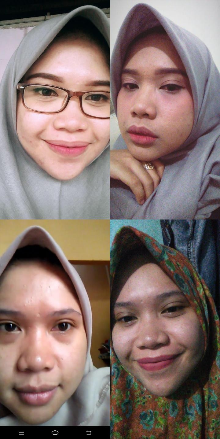 Apakah kamu pernah menjadi korban krim wajah yang mengandung  merkuri/hidroquinon? - Quora