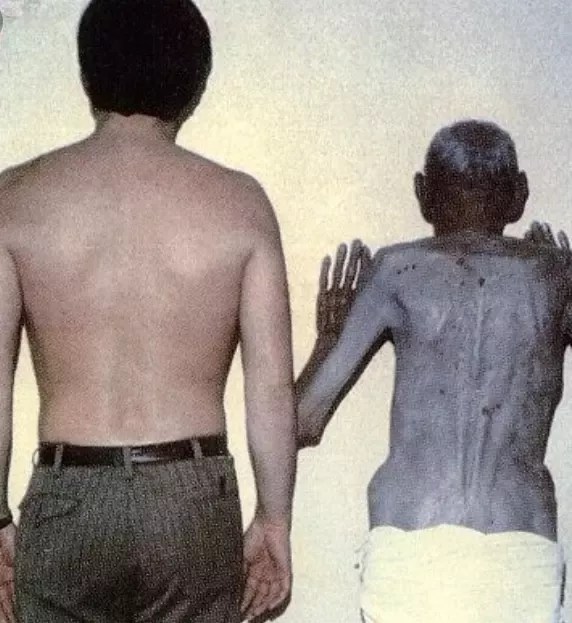 images Pictures Of Blue People quora