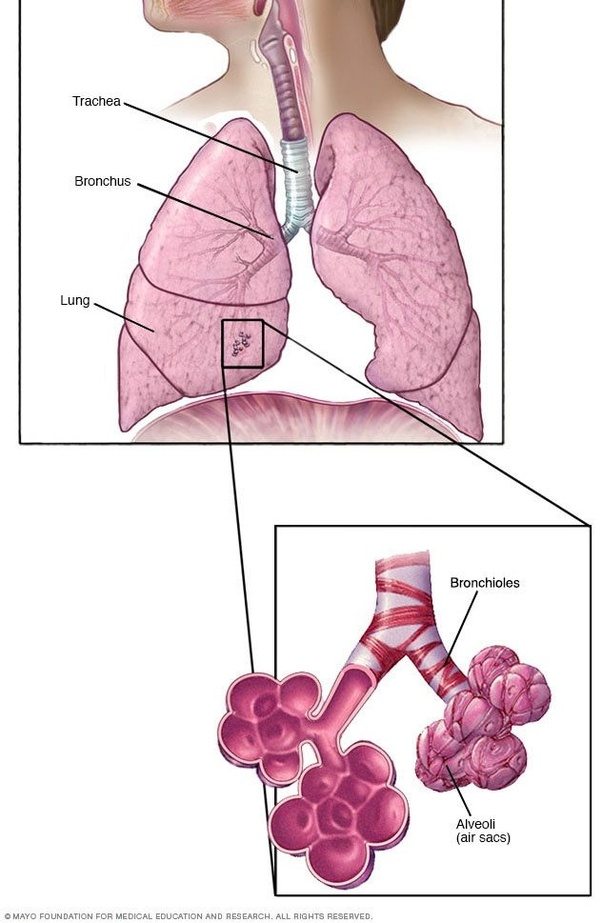 Most cases of lung cancer are associated with. How do alveoli and bronchi differ? - Quora