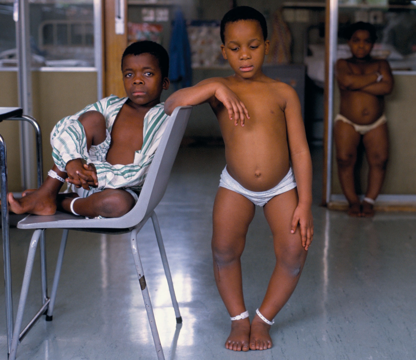 Apa itu penyakit Rakhitis? - Quora