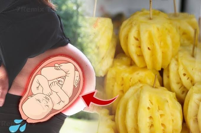 Apakah buah nanas bisa menyebabkan keguguran bagi Ibu hamil? Apakah itu  fakta atau mitos? - Quora