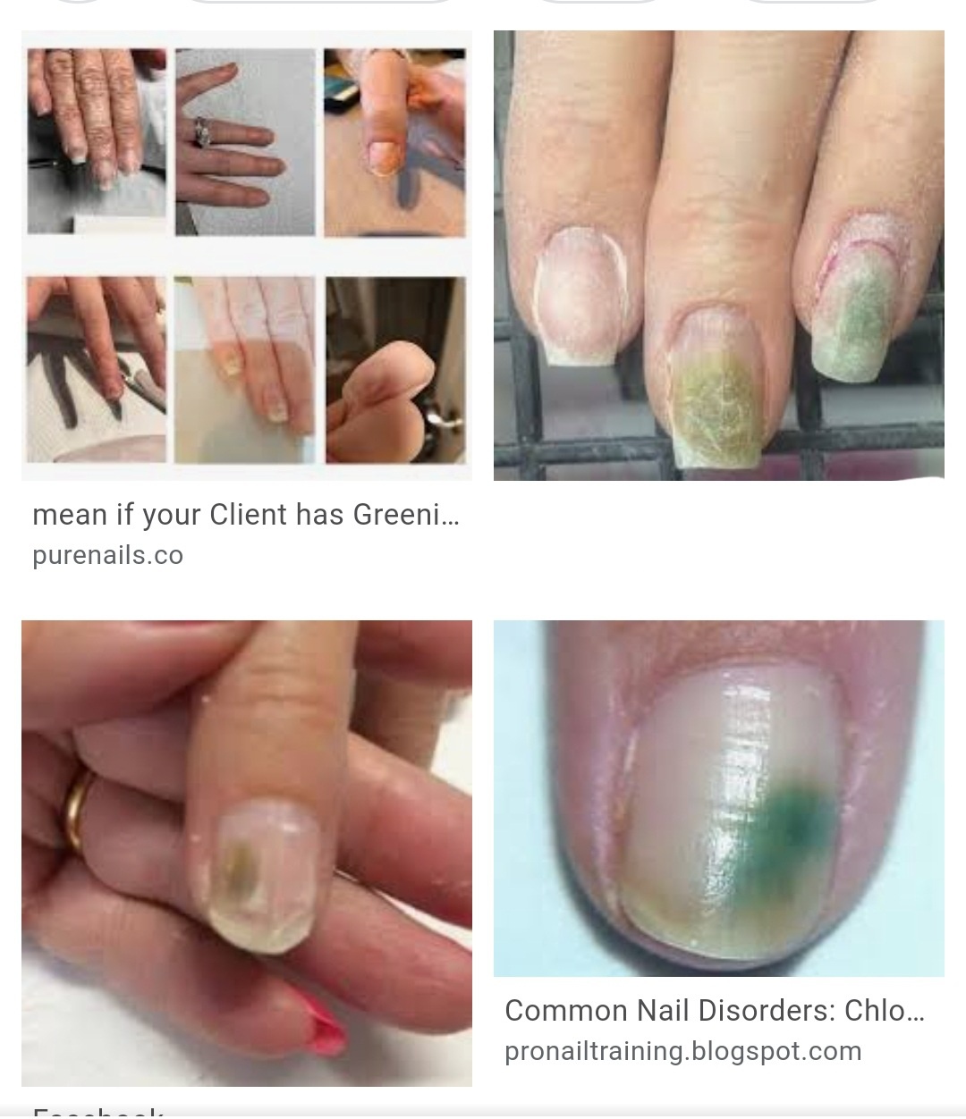 Apply a small amount of glue off™ along the cuticle line. My Nails Turned Green After A Week Of Fake Nails How Do I Get Rid Of It Quora