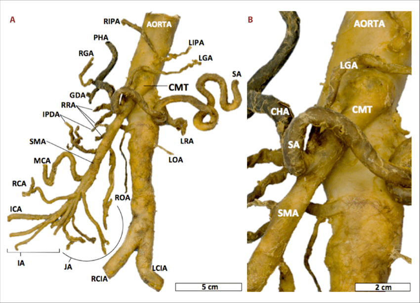 Apa kepanjangan singkatan DD di dunia kedokteran dan apa maksudnya? - Quora
