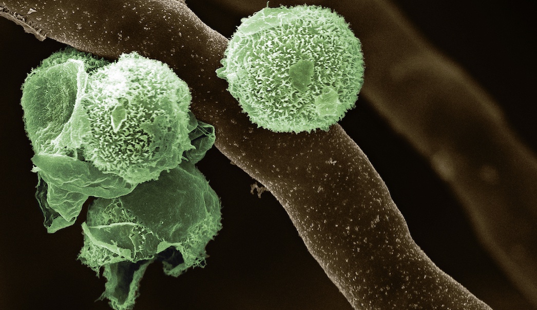 Apa sajakah hubungan simbiosis yang ada antara tumbuhan, jamur dan protista  (tidak harus ketiganya bersama-sama)? - Quora