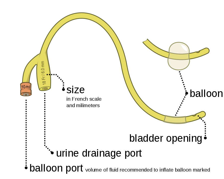 Bisakah teknisi UGD memasukkan kateter Foley? - Quora