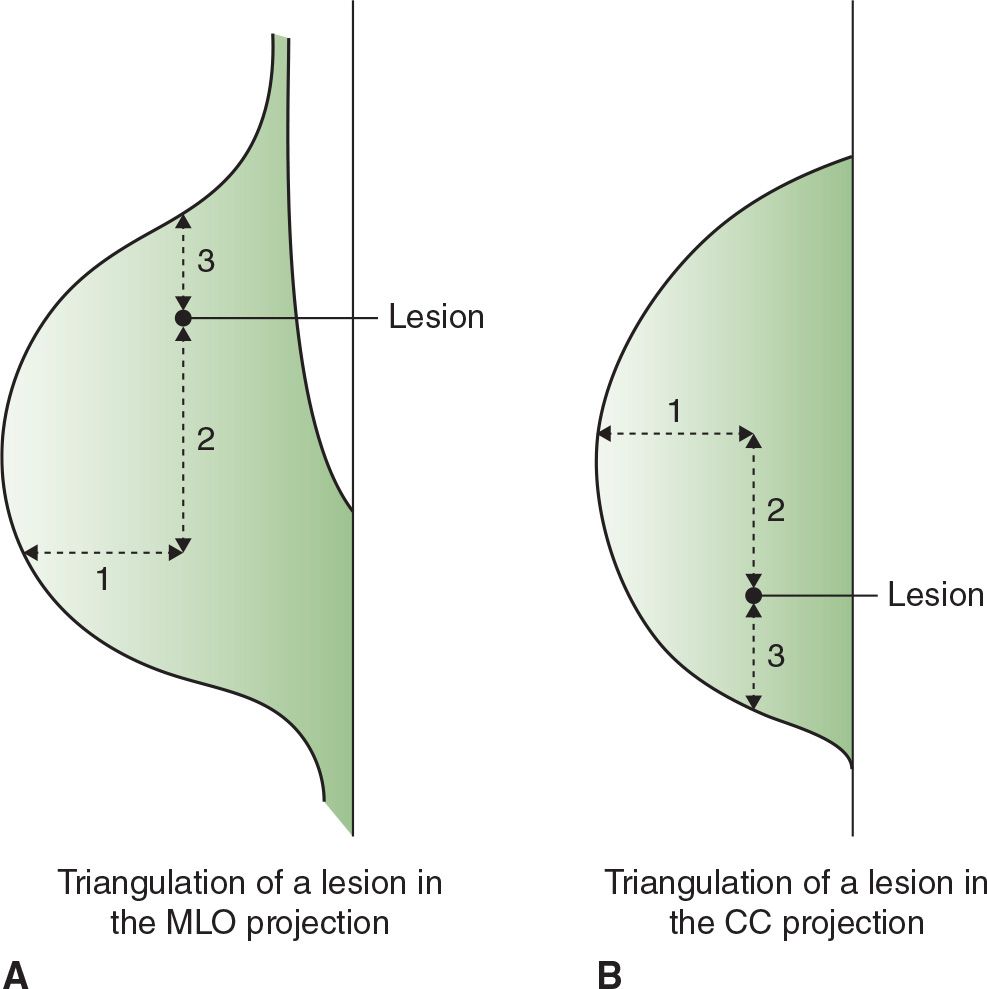 67 CHAPTER 1 TEST ANATOMY TestAnatomy