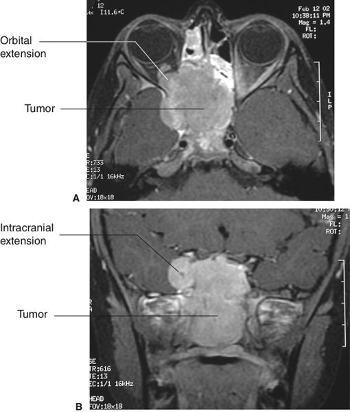 Head and Neck Radiology Key