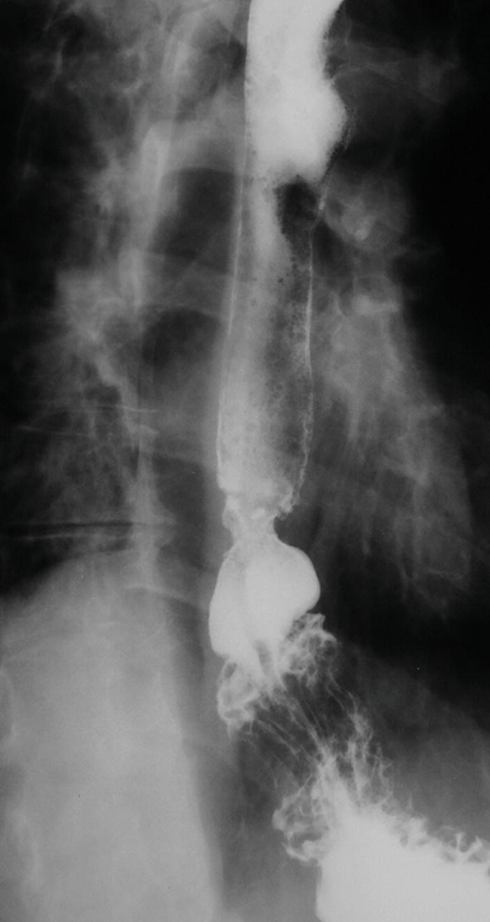 Pharynx and Esophagus Radiology Key