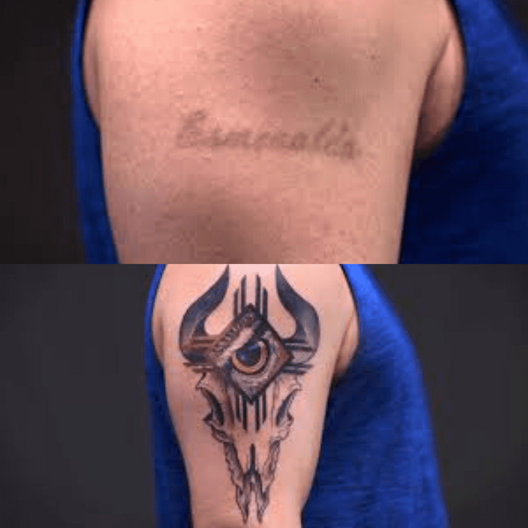 Tattoo Redo: Netflix's Tattoo Cover Up Show | Removery 1080_x_1080_png