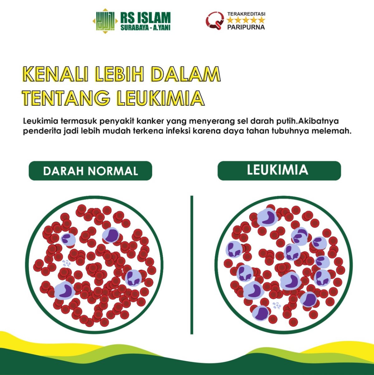 Tentang Leukimia – RS Islam Surabaya