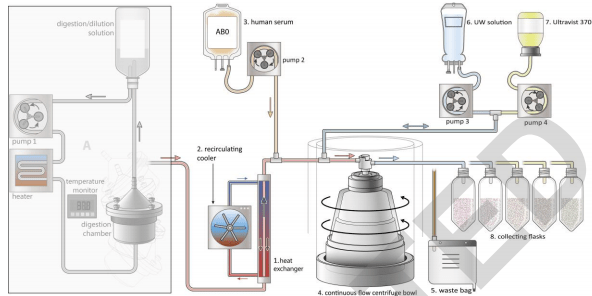 трансплантация поджелудочной железы