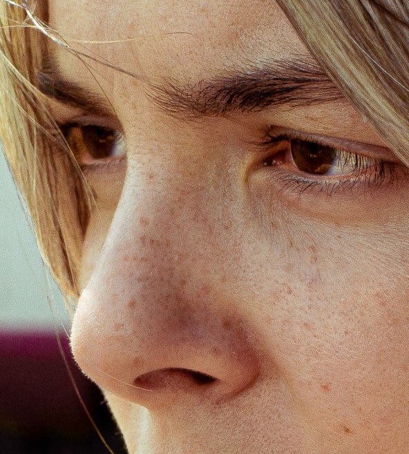 Arti dari kisaran nilai adalah sebagai berikut: Nose Bump Overview Causes Treatment Options And More Aedit