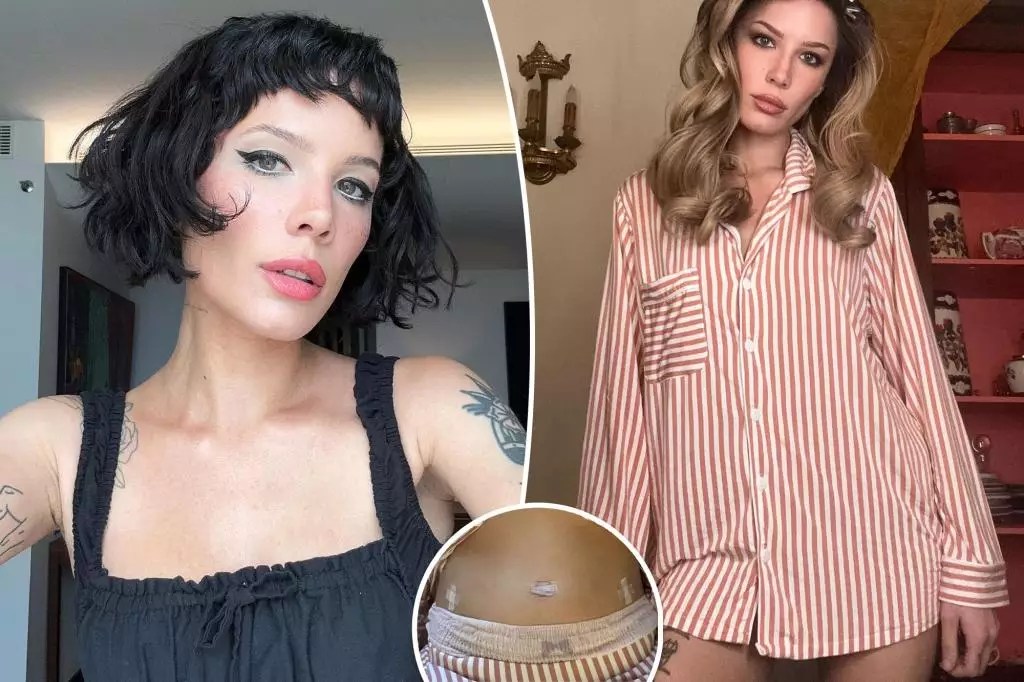 Breaking Down Halsey’s Journey with Endometriosis Breaking Down Halsey’s Journey with Endometriosis