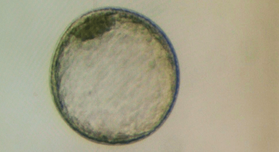 Equine Embryo Transfer