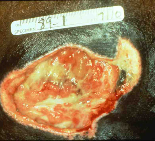 Craftmatic adjustable beds have many features and components. Northwest Regional Spinal Cord Injury System